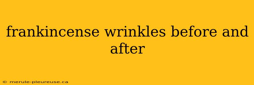 frankincense wrinkles before and after