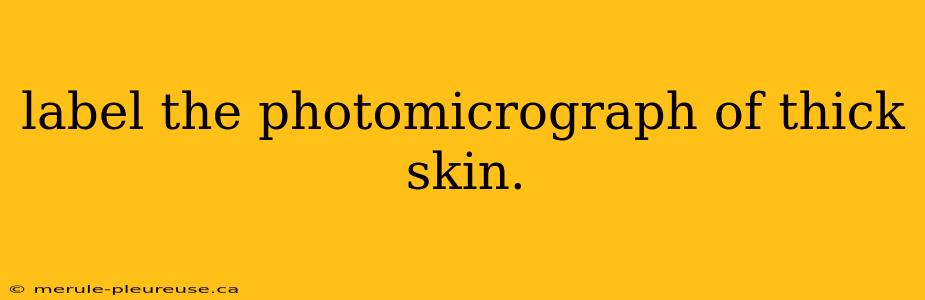 label the photomicrograph of thick skin.