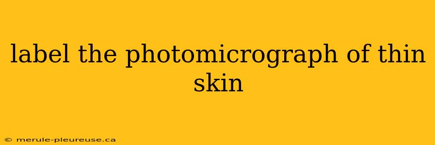 label the photomicrograph of thin skin