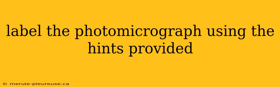 label the photomicrograph using the hints provided