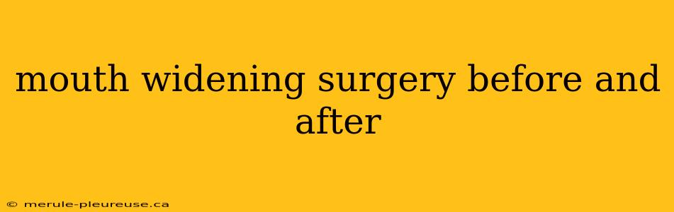 mouth widening surgery before and after