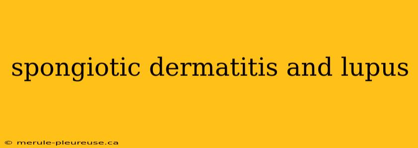 spongiotic dermatitis and lupus