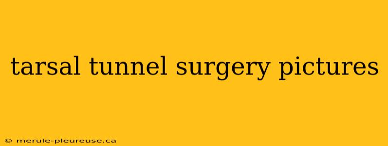 tarsal tunnel surgery pictures